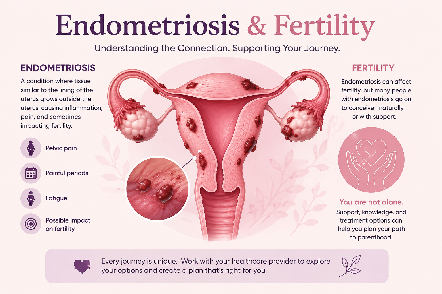 Endometriosis and fertility — diagnosis and treatment options at Myra IVF Centre Kenya