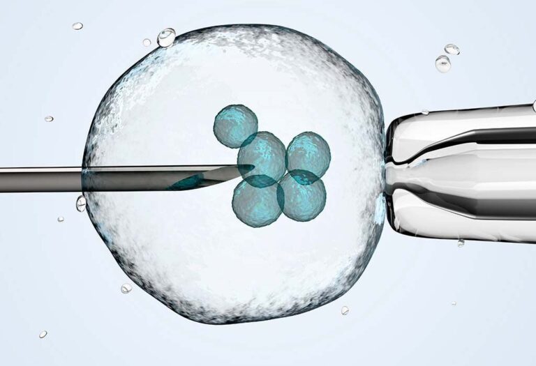 Assisted Lazer Hatching