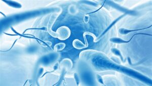 Azoospermia Treatment